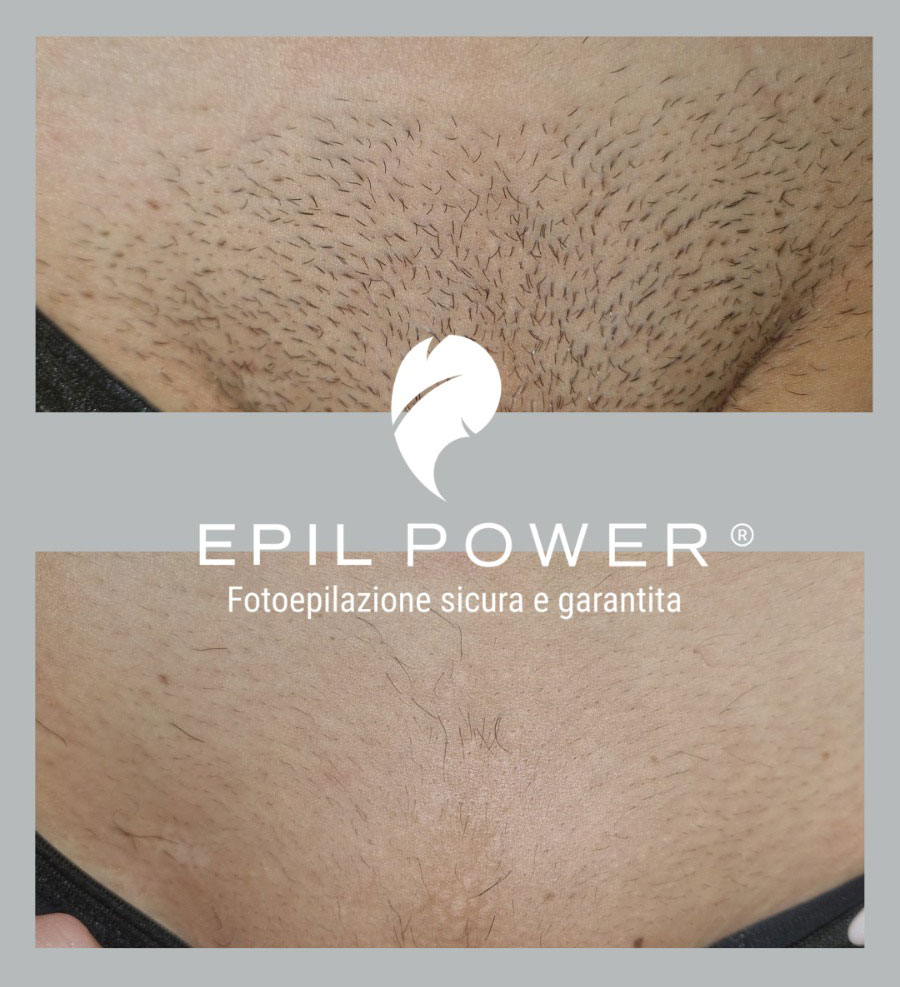 Il metodo